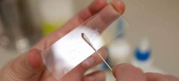 Ussimunade kraapimine